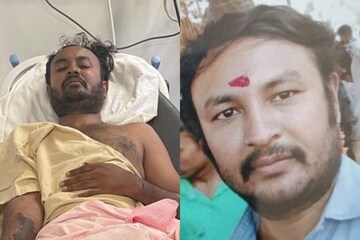 Bengaluru Acid Attack accused Nagesh hurt in police firing mrq | Acid Naga:  ಪೊಲೀಸರಿಂದ ತಪ್ಪಿಸಿಕೊಳ್ಳಲು ಯತ್ನ; ಆಸಿಡ್ ನಾಗನ ಕಾಲಿಗೆ ಗುಂಡೇಟು– News18 Kannada