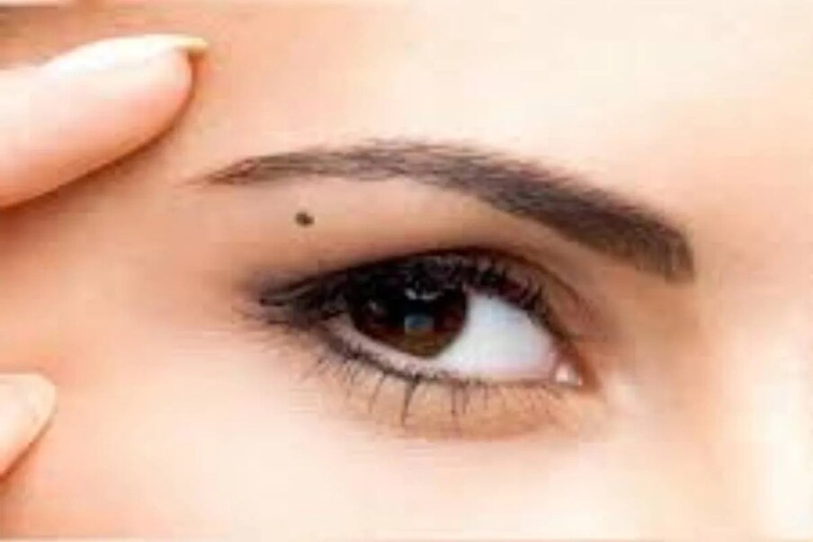 Moles Of Woman: ದೇಹದ ಈ ಭಾಗದಲ್ಲಿ ...