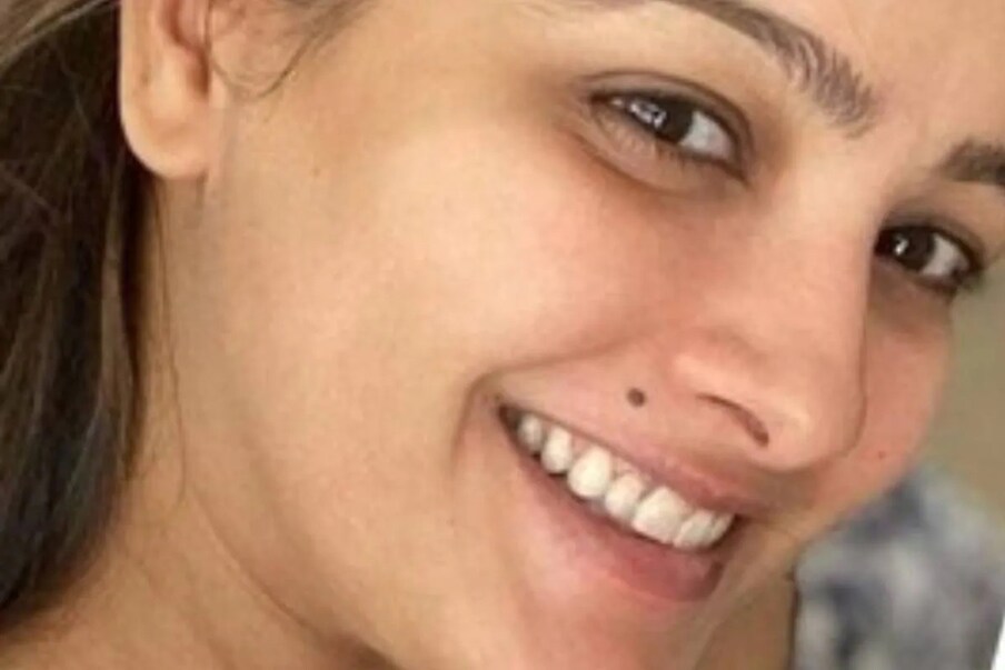 Moles Of Woman: ದೇಹದ ಈ ಭಾಗದಲ್ಲಿ ...