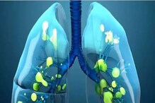 Lungs Health: ಈ ಪದಾರ್ಥಗಳ ಸೇವನೆ ಶ್ವಾಸಕೋಶದ ಸಮಸ್ಯೆಗೆ ಪರಿಹಾರ ನೀಡುತ್ತೆ