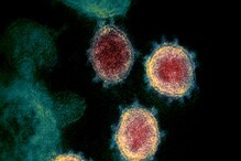 SARS-CoV-2 virus: ಆರೋಗ್ಯದ ಮೇಲೆ ಆಗೋ ಅನಾಹುತಗಳ ಬಗ್ಗೆ ಹೊಸ ಪ್ರಯೋಗ ಏನು ಹೇಳಿದೆ? SARS-CoV-2 virus: ಆರೋಗ್ಯದ ಮೇಲೆ ಆಗೋ ಅನಾಹುತಗಳ ಬಗ್ಗೆ ಹೊಸ ಪ್ರಯೋಗ ಏನು ಹೇಳಿದೆ?