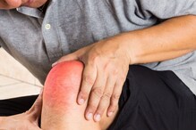 Winter Joint Pain: ಚಳಿಗಾಲದಲ್ಲಿ ಕೀಲು ನೋವು ಬರಬಾರದು ಅಂದ್ರೆ ಈ ಕೆಲಸ ಮಾಡಿ ಸಾಕು Winter Joint Pain: ಚಳಿಗಾಲದಲ್ಲಿ ಕೀಲು ನೋವು ಬರಬಾರದು ಅಂದ್ರೆ ಈ ಕೆಲಸ ಮಾಡಿ ಸಾಕು