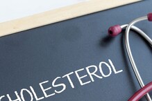 High Cholesterol: ಅಧಿಕ ಕೊಲೆಸ್ಟ್ರಾಲ್ ಕೋವಿಡ್ ಅಪಾಯವನ್ನು ಹೆಚ್ಚಿಸುತ್ತಂತೆ High Cholesterol: ಅಧಿಕ ಕೊಲೆಸ್ಟ್ರಾಲ್ ಕೋವಿಡ್ ಅಪಾಯವನ್ನು ಹೆಚ್ಚಿಸುತ್ತಂತೆ