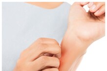Itching Remedy: ಚಳಿಗಾಲದಲ್ಲಿ ತುರಿಕೆ ಹೆಚ್ಚಾಗಿದ್ರೆ ಟೆನ್ಷನ್ ಬೇಡ, ಇಲ್ಲಿದೆ ನೋಡಿ ಸೂಪರ್ ಮನೆಮದ್ದು Itching Remedy: ಚಳಿಗಾಲದಲ್ಲಿ ತುರಿಕೆ ಹೆಚ್ಚಾಗಿದ್ರೆ ಟೆನ್ಷನ್ ಬೇಡ, ಇಲ್ಲಿದೆ ನೋಡಿ ಸೂಪರ್ ಮನೆಮದ್ದು