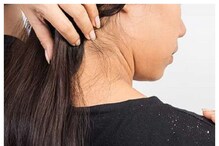 Hair Loss: ಚಳಿಗಾಲದಲ್ಲಿ ಉಂಟಾಗುವ ತಲೆ ಹೊಟ್ಟಿನಿಂದ ಕೂದಲು ಉದುರುತ್ತಿದೆಯಾ?