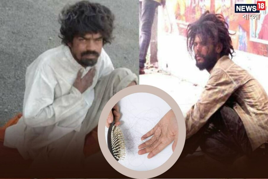  ದಿನವಿಡೀ ನಾವು ಅನೇಕ ಭಿಕ್ಷುಕರು ಮತ್ತು ಅಲೆಮಾರಿಗಳನ್ನು ಅವರ ದಾರಿಯಲ್ಲಿ ನೋಡುತ್ತೇವೆ. ಆದರೆ ಅವರಲ್ಲಿ ಒಂದು ವಿಷಯವನ್ನು ನೀವು ಎಂದಾದರೂ ಗಮನಿಸಿದ್ದೀರಾ, ಬಹುತೇಕ ಎಲ್ಲರೂ ತುಂಬಾ ದಪ್ಪ ಕೂದಲು ಹೊಂದಿರುತ್ತಾರೆ. ಆದರೆ ಅವರು ಎಣ್ಣೆಯನ್ನುಹಾಕೋದಿಲ್ಲ ಅಥವಾ ಶಾಂಪೂವಿನಿಂದ ಕೂದಲನ್ನು ತೊಳೆಯುವುದಿಲ್ಲ. ಆದರೆ ಅಂತಹ ದಪ್ಪ ಕೂದಲು ಹೇಗೆ?