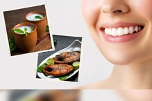 Oral Health: ಮಜ್ಜಿಗೆ, ಮೀನು ಅಷ್ಟೇ ಅಲ್ಲ, ಈ ಆಹಾರಗಳು ಹಲ್ಲುಗಳ ಆರೋಗ್ಯ ಕಾಪಾಡುತ್ತೆ!