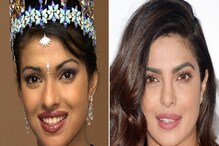 Bollywood Actress: ಪ್ಲಾಸ್ಟಿಕ್ ಸರ್ಜರಿ ವೇಳೆ ವೈದ್ಯರ ಎಡವಟ್ಟು, ಮುಖ ಕಂಡು ಪ್ರಿಯಾಂಕಾ ಚೋಪ್ರಾ ಫುಲ್ ಶಾಕ್!