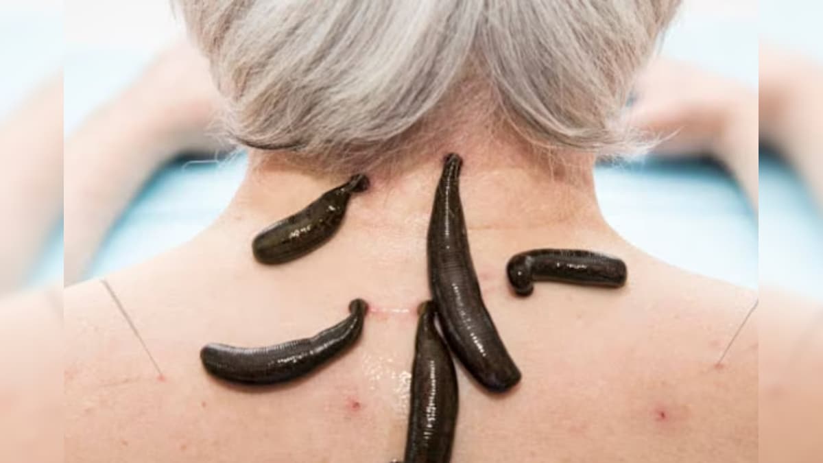 ರಕ್ತ ಹೀರುವ ಜಿಗಣೆಯಿಂದಲೂ ಇದೇ ನಾನಾ ಪ್ರಯೋಜನ; ಕೇಳಿದ್ರೆ ಶಾಕ್ ಆಗ್ತೀರಿ! . see