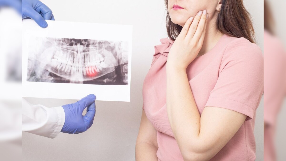 Home Remedie ನಿಮಗೆ ತುಂಬಾ ಹಲ್ಲು ನೋವಾ; ಹಾಗಾದ್ರೆ ಈ ಮನೆಮದ್ದುಗಳನ್ನು ಟ್ರೈ