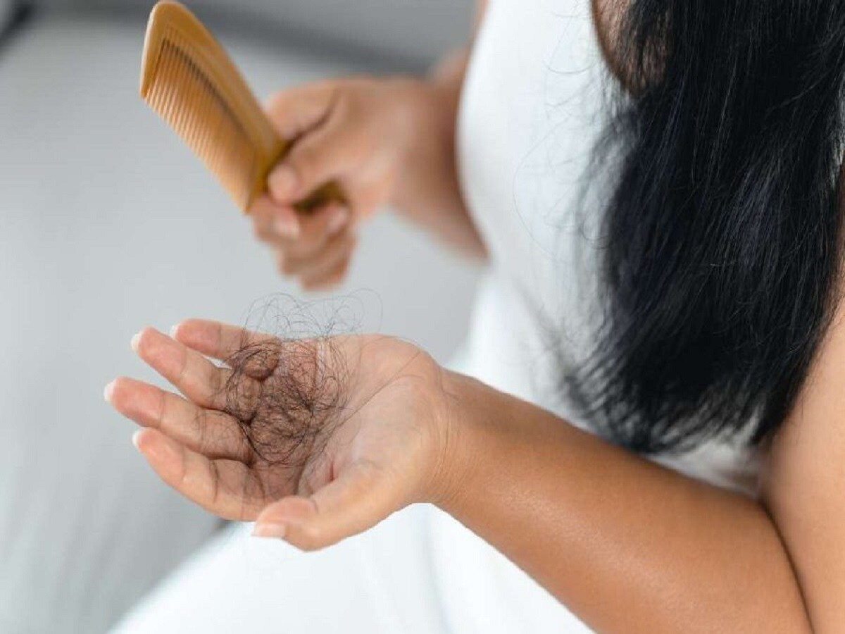 Hairfall Remedy: ಕೇವಲ 7 ದಿನಗಳಲ್ಲಿ ಕೂದಲು ಉದುರೋದು ನಿಲ್ಲಬೇಕಾ? ಹಾಗಾದ್ರೆ ಈ 3 ...