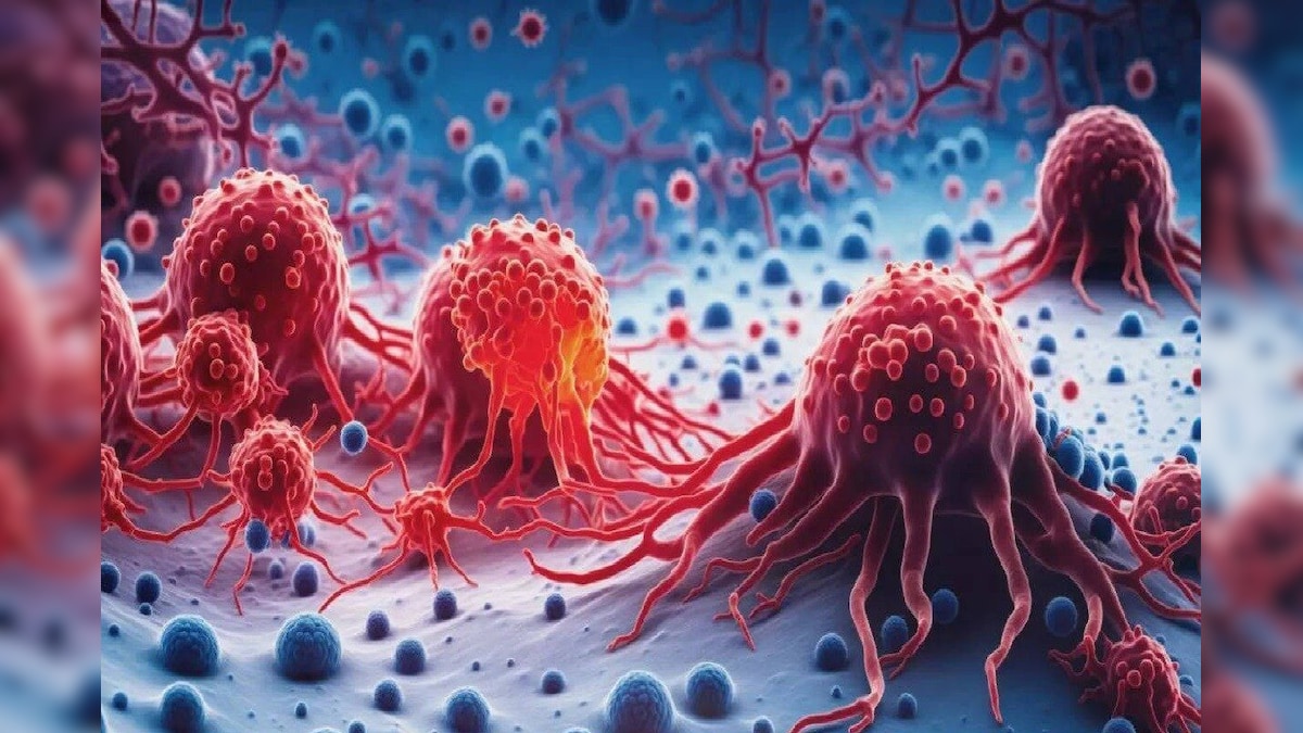 Health Care: ಕ್ಯಾನ್ಸರ್ ಬಂದ್ರೆ ಮೊದಲು ದೇಹದ ಈ ಭಾಗದಲ್ಲೇ ಗಡ್ಡೆ ಕಾಣಿಸಿಕೊಳ್ಳೋದಂತೆ; ರಿವೀಲ್ ಆಯ್ತು ಶಾಕಿಂಗ್ ರಿಪೋರ್ಟ್​!