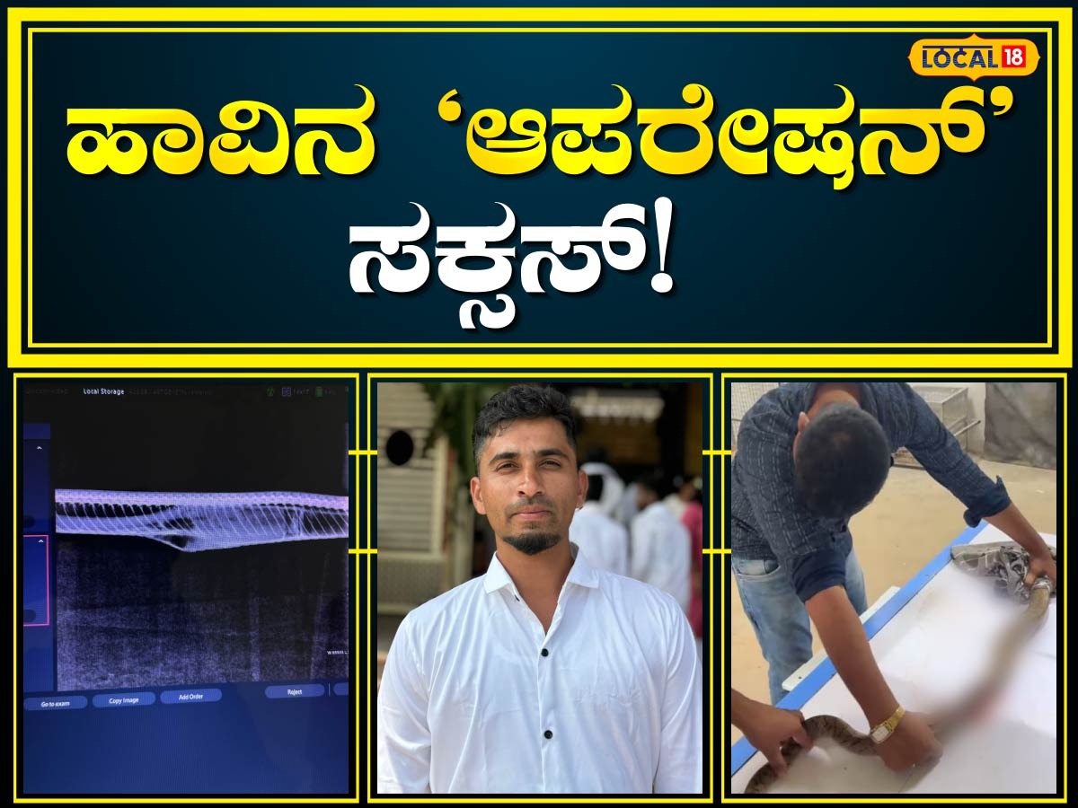 Snake Surgery: ಪ್ಲಾಸ್ಟಿಕ್ ಬಾಟಲಿ ನುಂಗಿ ಒದ್ದಾಡಿದ್ದ ಹಾವಿಗೆ ಜೀವದಾನ, ಸಾವಿನ ...