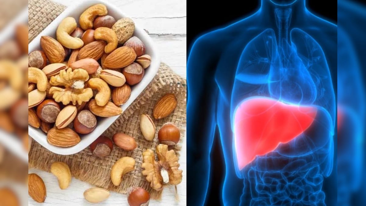 Health Care: ಫ್ಯಾಟಿ ಲಿವರ್ ಸಮಸ್ಯೆ ನಿಮಗಿದ್ಯಾ? ಹಾಗಾದ್ರೆ ನೀವು ಇವುಗಳನ್ನು ತಿನ್ನಲೇಬೇಕು!
