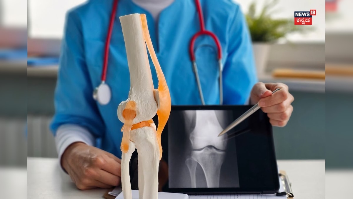 Bone Health: ಮೂಳೆ ಮುರಿಯೋ ಮುಂಚೆ ಎಚ್ಚರ! ಸೈಲೆಂಟ್ ಆಗಿ ಕಾಡ್ತಿದೆ ಈ ಕಾಯಿಲೆ!