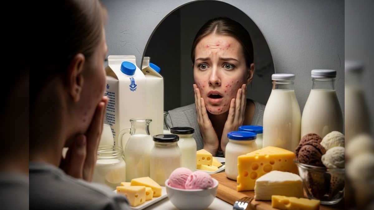 Skin Care: ಹಾಲು ಕುಡಿದ್ರೆ ಮುಖದಲ್ಲಾಗುತ್ತಾ ಮೊಡವೆ? ಈ  ಸಮಸ್ಯೆಗೆ ಅಸಲಿ ಕಾರಣ ಇಲ್ಲಿದೆ ನೋಡಿ!