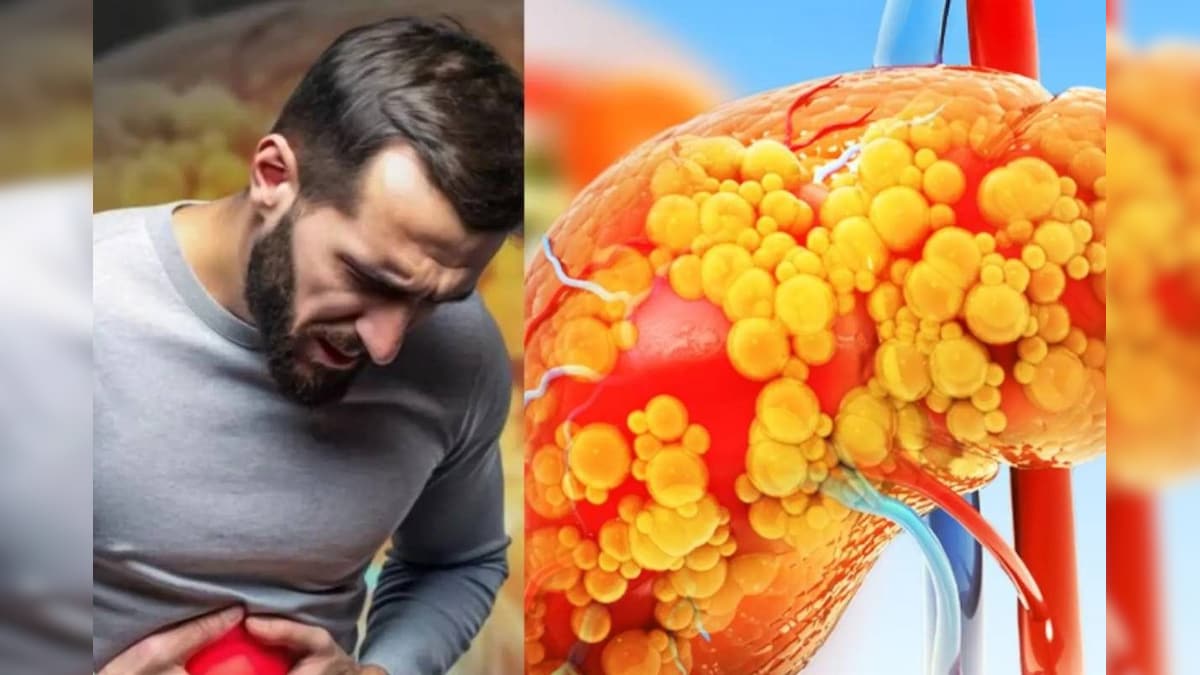 Liver Health: ನಿಮ್ಮ ಲಿವರ್ ಆರೋಗ್ಯವಾಗಿದ್ಯಾ? ಇಲ್ವಾ?​ ಮಲದ ಬಣ್ಣದಿಂದ ತಿಳಿಯಬಹುದು ಯಕೃತ್ತದ ಸಮಸ್ಯೆ!
