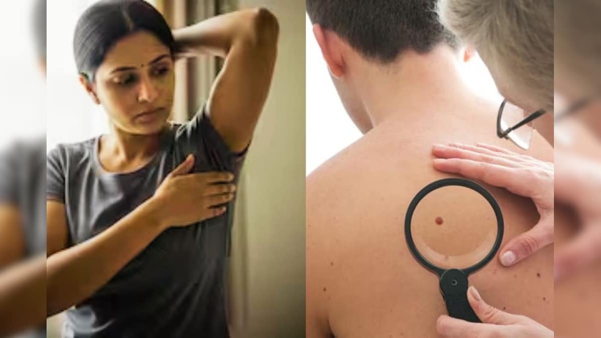 Cancer: ಸ್ಟೇಜ್ 1 ಕ್ಯಾನ್ಸರ್ ನೀಡುತ್ತೆ ಬಿಗ್​​ ಅಲರ್ಟ್!​ ದೇಹದ ಈ ಬದಲಾವಣೆ ಬಗ್ಗೆ ನಿರ್ಲಕ್ಷ್ಯ ಮಾಡಲೇಬೇಡಿ