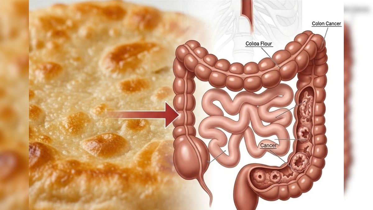Health Tips: ಮೈದಾ ಹಿಟ್ಟು ಕರುಳಿಗೆ ಅಂಟಿಕೊಳ್ಳುತ್ತಾ? ದಿನ ಪರೋಟಾ ತಿನ್ನುವವರಿಗೆ ಇದು ಶಾಕಿಂಗ್ ನ್ಯೂಸ್​!