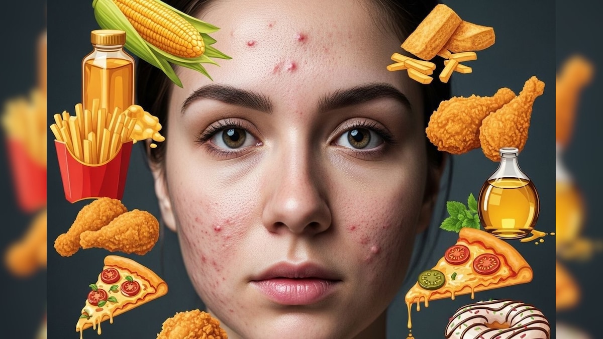 Skin care Tips: ಈ 3 ಆಹಾರಗಳು ನಿಮ್ಮ ತ್ವಚೆಗೆ ಶತ್ರುವಿದ್ದಂತೆ, ಆದರೂ ಪ್ರತಿದಿನ ತಿಂತಾರಾ?; ಹುಷಾರ್, ಅಂತಿದ್ದಾರೆ ತಜ್ಞರು!