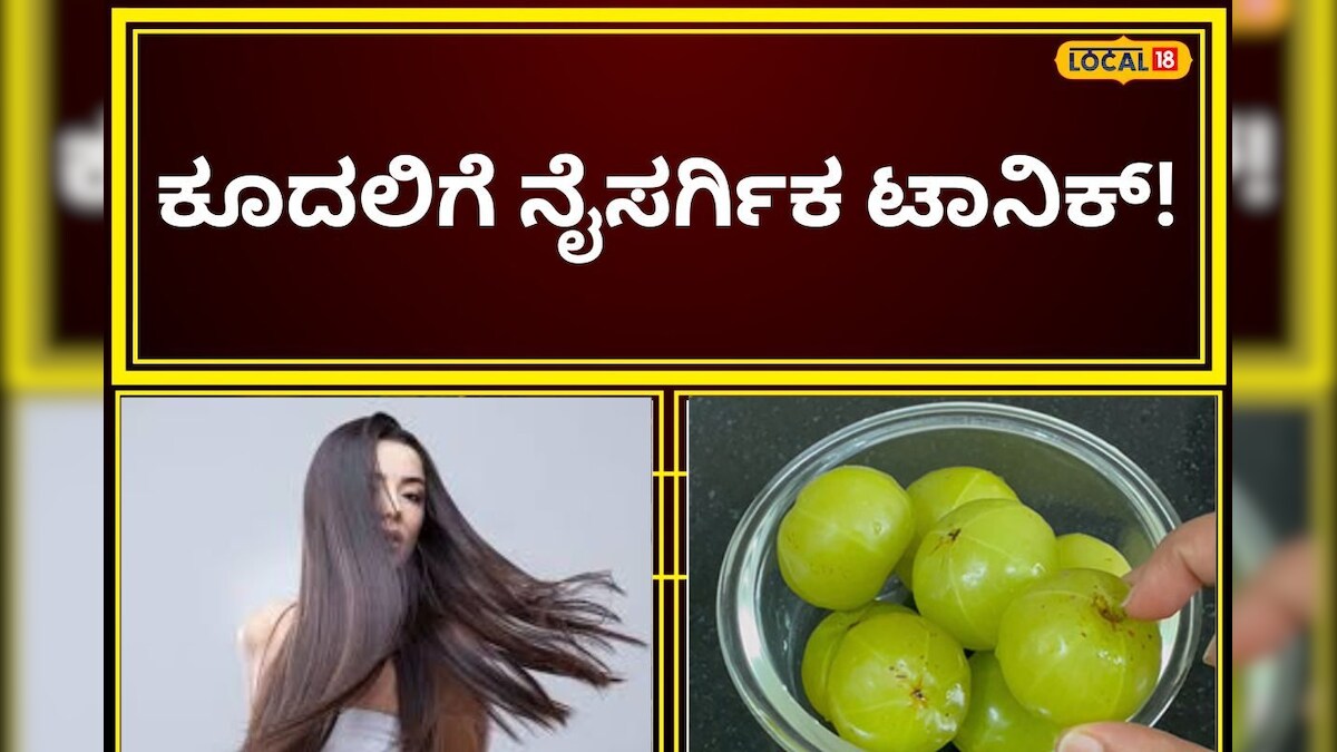Hair Care Tips: ಕೂದಲಿನ ಆರೈಕೆ ಈ ರೀತಿ ಮಾಡಿ, ಮನೆಯಲ್ಲಿ ಈ ವಸ್ತು ಇದ್ರೆ ಸುಲಭ!