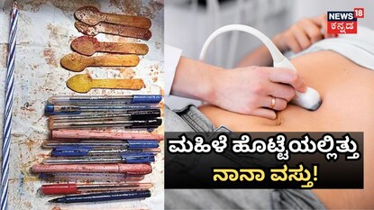 ಮಹಿಳೆ ಹೊಟ್ಟೆಯಲ್ಲಿತ್ತು ನಾನಾ ವಸ್ತು!