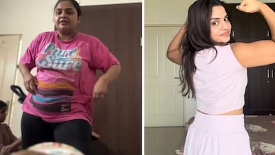 Woman Loses 32 Kg in 11 Months by Ditching 5 Foods