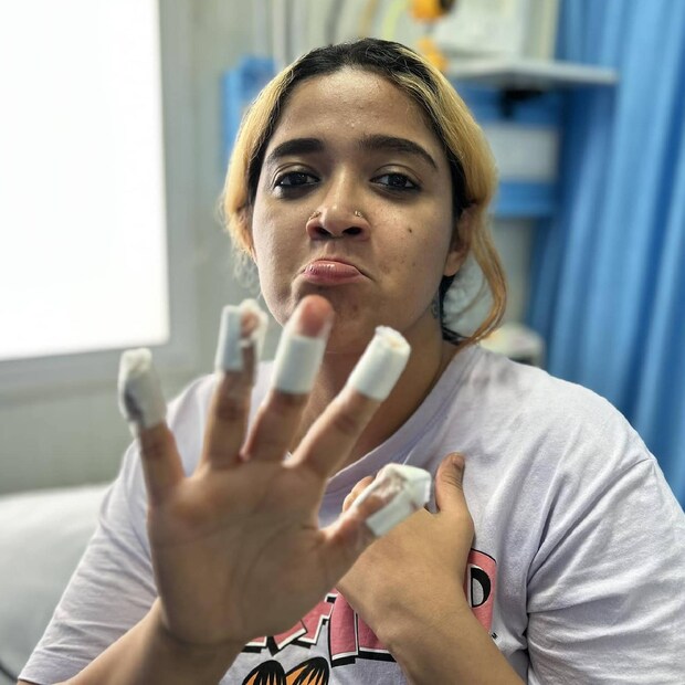 Abhirami Suresh, Abhirami Suresh wound, Abhirami Suresh injury, അഭിരാമി സുരേഷ്