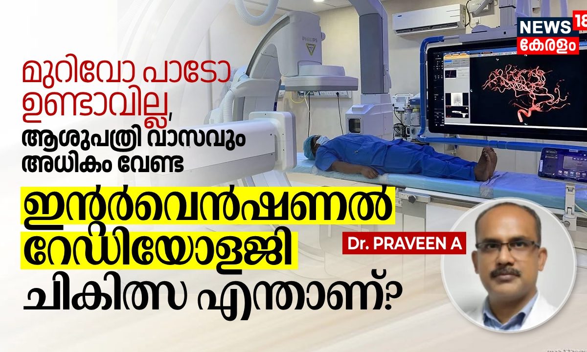 മുറിവോ പാടോ ഉണ്ടാവില്ല, ആശുപത്രി വാസവും അധികം വേണ്ട; എന്താണ് ഇന്റർവെൻഷണൽ റേഡിയോളജി ചികിത്സ?