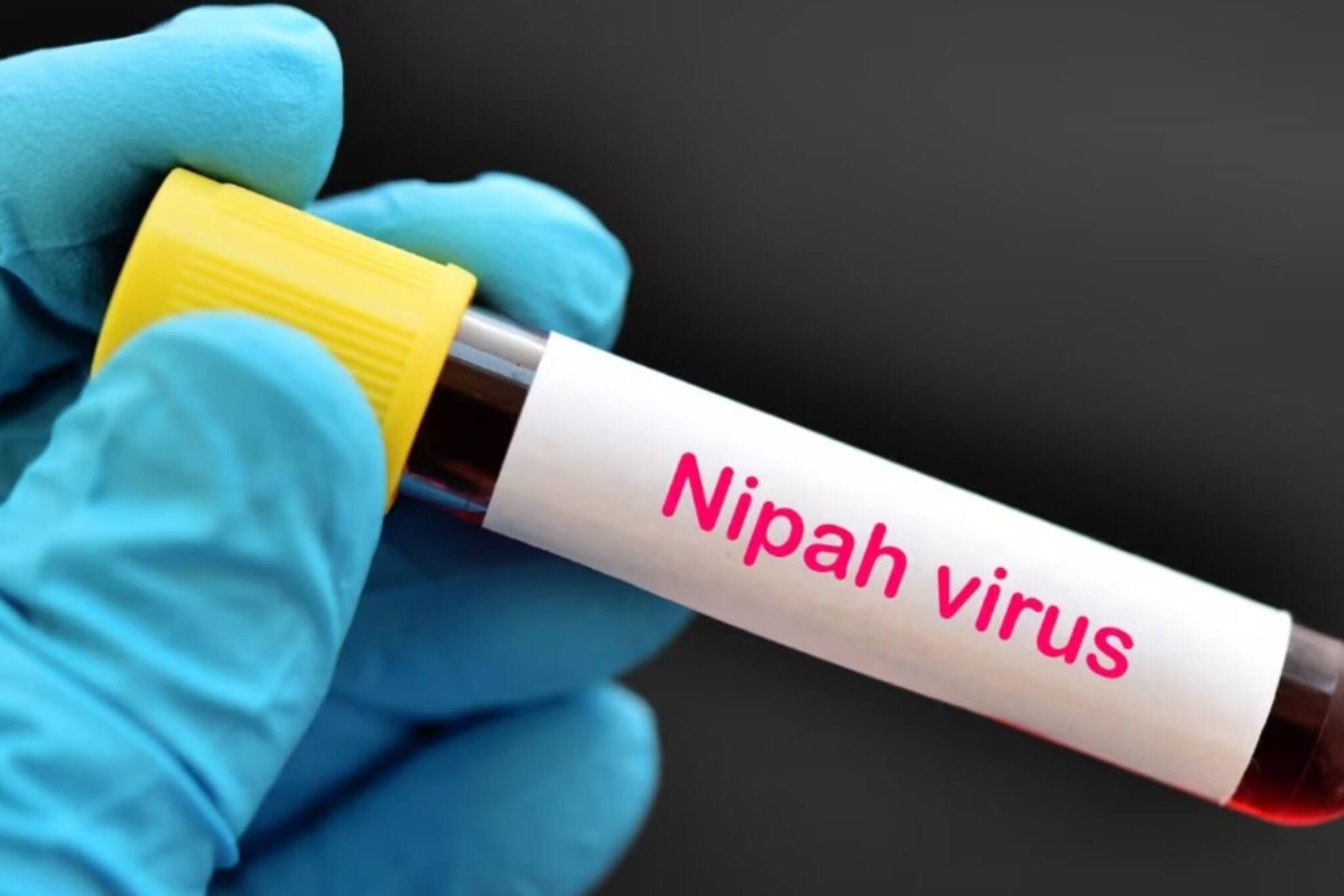 നിപയിൽ ആശ്വാസം; 10 പേരുടെ പരിശോധന ഫലങ്ങൾ കൂടി നെഗറ്റീവ്