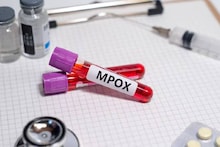 Mpox: അന്താരാഷ്ട്ര വിമാനത്താവളങ്ങളിൽ ജാ​ഗ്രതാ നിർദേശവുമായി കേന്ദ്രം; മൂന്ന് ആശുപത്രികളിൽ ക്രമീകരണങ്ങൾ തുടങ്ങി