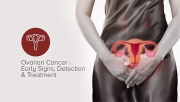 ഈ നാല് ലക്ഷണങ്ങൾ ഉണ്ടോ? അണ്ഡാശയ അർബുദം തുടക്കത്തിൽ തന്നെ തിരിച്ചറിയാം