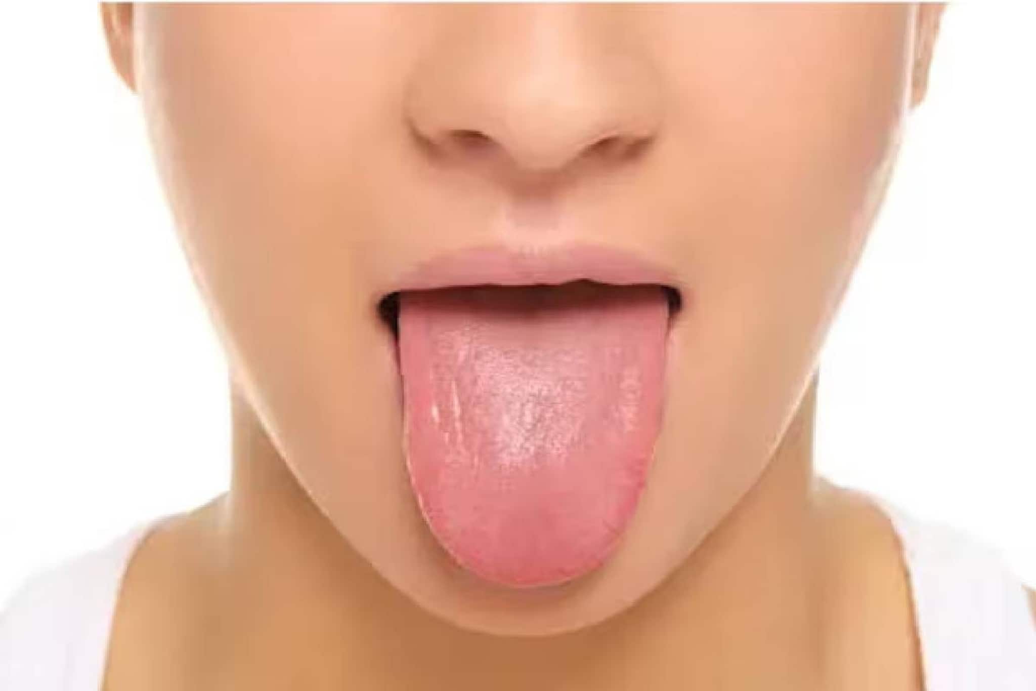 നാവ് നന്നായാൽ എല്ലാം നന്നാവും; നാവ് പരിശോധിച്ച് 98 ശതമാനം രോഗങ്ങളും കൃത്യമായി കണ്ടെത്തി എഐ മോഡല്‍