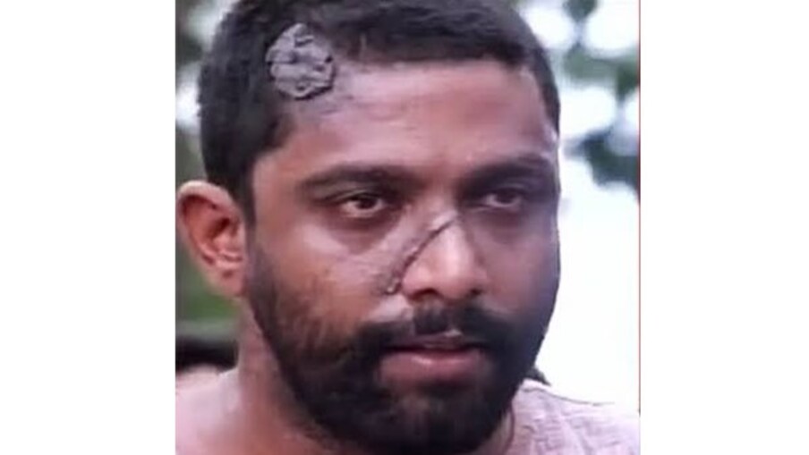  മധുരയില്‍ എന്‍ഫോഴ്‌സ്‌മെന്റ് അസിസ്റ്റന്റ് കമ്മീഷണറായി വിരമിച്ച മോഹന്‍രാജിനും ഭാര്യയ്ക്കും ഏത് ആശുപത്രിയിലും ചികിത്സ തേടാനുള്ള ഇൻഷുറൻസ് സൗകര്യമുണ്ട്. സാമ്പത്തിക പ്രതിസന്ധിയും കുടുംബത്തിനില്ല. ജനറല്‍ ആശുപത്രിയിലെ പേ വാര്‍ഡിലാണ് മോഹൻ രാജ് കഴിയുന്നതെന്നും കുടുംബം അറിയിച്ചു.