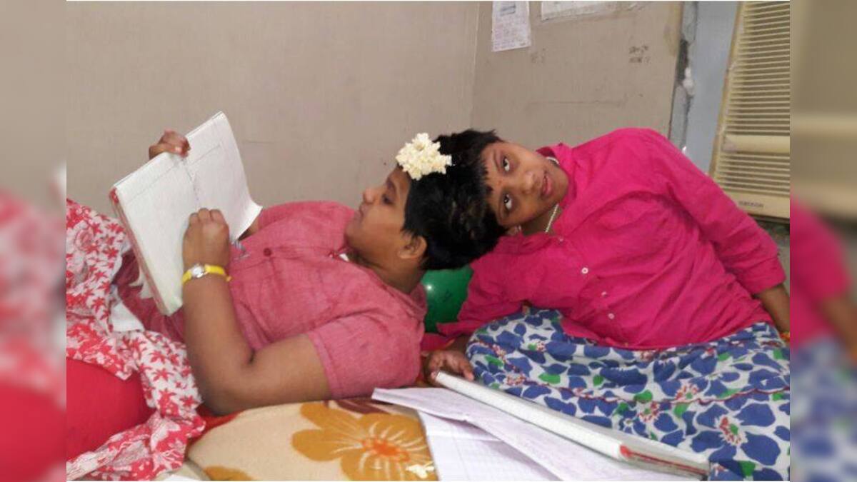 Conjoined twins Veena and Vani Passes Class 10 in Flying Colours