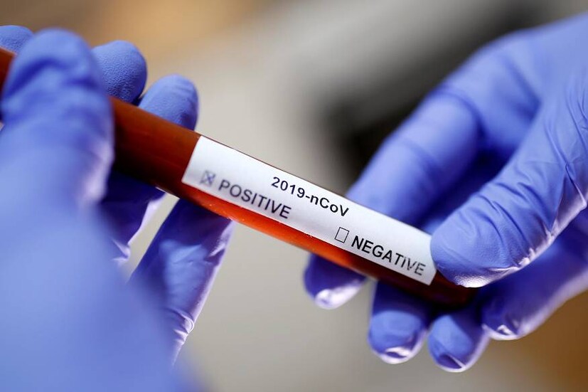 coronavirus, corona virus, coronavirus india, coronavirus in india, Covid 19, coronavirus kerala, coronavirus update, coronavirus symptoms, coronavirus in kerala, corona virus india, corona virus kerala, symptoms of coronavirus, coronavirus italy, കൊറോണ വൈറസ്, കൊറോണ കേരളത്തിൽ, കോവിഡ് 19
