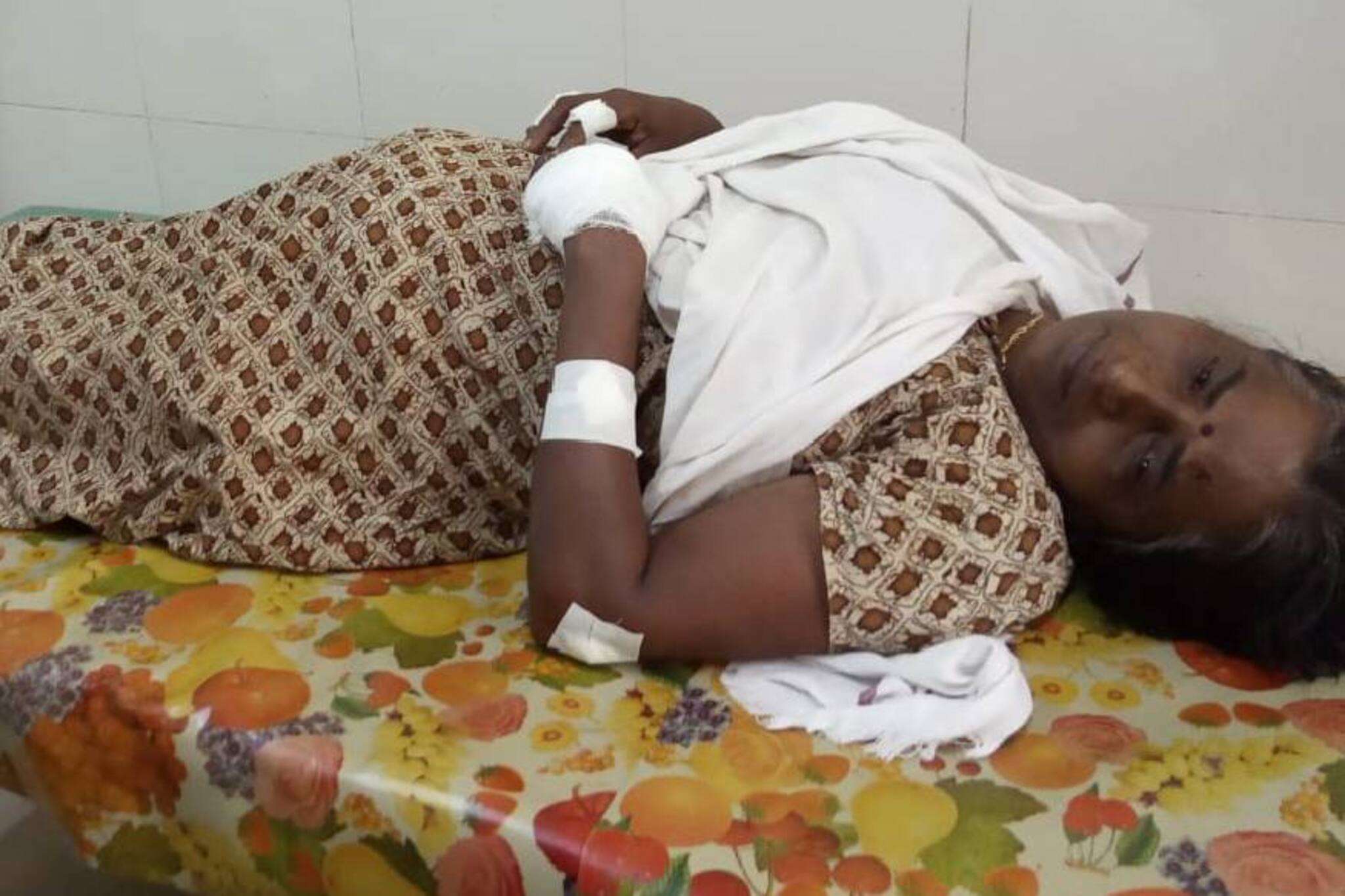 കണ്ണൂരിൽ തൊഴിലുറപ്പ് ജോലിയ്ക്കിടെ ബോംബ് സ്ഫോടനം; സ്ത്രീയ്ക്ക് പരിക്ക്