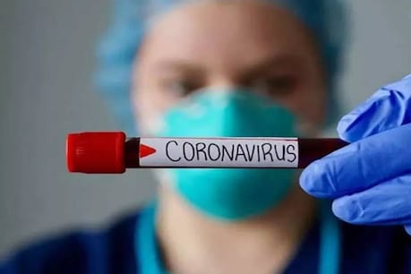 COVID 19| സൗദിയിൽ ചികിത്സയിലായിരുന്ന നാല് വിദേശികൾ കൂടി മരിച്ചു; പുതുതായി 518 പേർക്ക് കോവിഡ് COVID 19| സൗദിയിൽ ചികിത്സയിലായിരുന്ന നാല് വിദേശികൾ കൂടി മരിച്ചു; പുതുതായി 518 പേർക്ക് കോവിഡ്