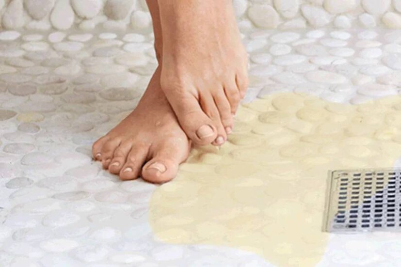  5: യോനിയിൽ നിന്നോ ലിംഗത്തിൽ നിന്നോ പച്ച അല്ലെങ്കിൽ മഞ്ഞ നിറത്തിലെ സ്രവം: ക്ലമീഡിയ, ഗൊണോറിയ, ട്രൈക്കോമോണിയാസിസ് തുടങ്ങിയ ലൈംഗിക രോഗ ബാധിതരായ ആർക്കും ലിംഗത്തിൽ നിന്നോ യോനിയിൽ നിന്നോ പച്ചകലർന്നതോ മഞ്ഞനിറമുള്ളതോ ആയ സ്രവം ഉണ്ടാകാം. സ്രവത്തിന് ഒരു ഗന്ധം ഉണ്ടാകാം