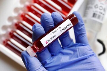 യാചകര്‍ക്ക് ആന്‍റിജൻ പരിശോധനയും താമസസൗകര്യവും; പദ്ധതി തയ്യാറാക്കി തിരുവനന്തപുരം നഗരസഭ