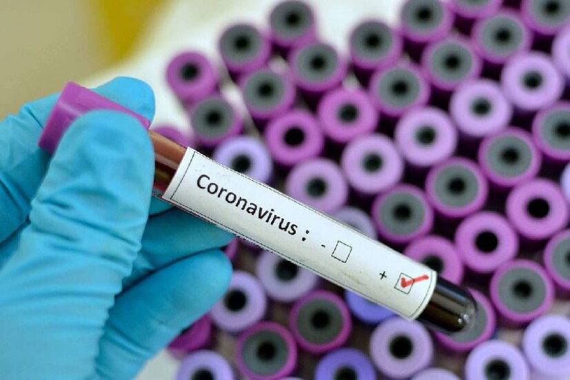 covid19, corona virus, antigen test fee, covid antigen test, antigen test in private lab, കോവിഡ്19, കൊറോണ വൈറസ്, ആന്‍റിജൻ ടെസ്റ്റ്