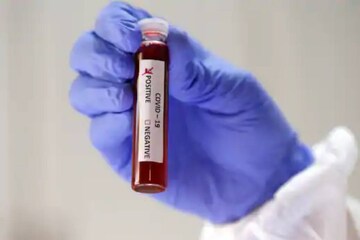 Covid 19 | വാക്സിൻ എത്തിയാലും കോവിഡ് മുക്തി ഉടനില്ല; കടമ്പകളേറെ