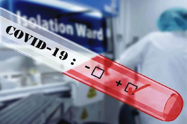 Covid 19 | സംസ്ഥാനത്ത് ഇന്ന്  176 മരണം; 28514 പേർക്ക് കോവിഡ്