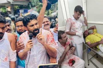 പാലക്കാട്ട് യൂത്ത് കോൺഗ്രസ് മാർച്ച്: വി.ടി ബൽറാമുൾപ്പടെ അൻപതോളം പേർക്ക് പരുക്ക് പാലക്കാട്ട് യൂത്ത് കോൺഗ്രസ് മാർച്ച്: വി.ടി ബൽറാമുൾപ്പടെ അൻപതോളം പേർക്ക് പരുക്ക്