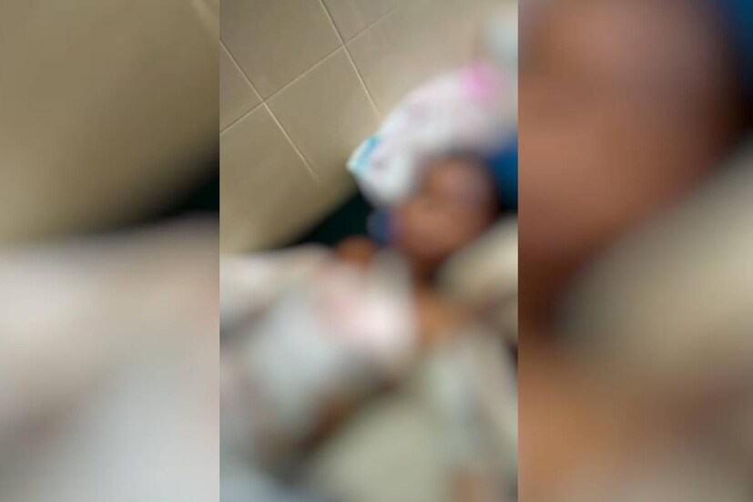  തെലങ്കാനയിലെ ഖമ്മം ജില്ലയിൽ ഇക്കഴിഞ്ഞ സെപ്റ്റംബർ പതിനെട്ടിനാണ് ക്രൂര സംഭവം അരങ്ങേറിയത്. പെൺകുട്ടി ജോലിക്കായി നിന്നിരുന്ന വീട്ടിലെ ഇരുപത്തിയാറുകാരനാണ് പീഡന ശ്രമം നടത്തിയത്. ഇത് എതിർത്തതോടെ പെണ്‍കുട്ടിയെ തീകൊളുത്തുകയായിരുന്നു.