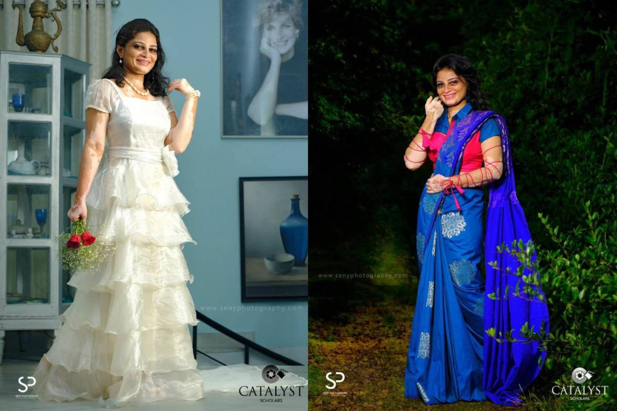 'സ്വസ്ഥതയും സമാധാനവുമാണ് സൗന്ദര്യം'; ലൂക്കോഡർമ മോഡലായ മഞ്ജു കുട്ടികൃഷ്ണൻ പറയുന്നു