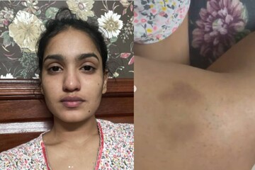 കോവിഡ് നിസാരമല്ല, ക്വറന്റീനും; അനുഭവം വിവരിച്ച് സാനിയ അയ്യപ്പൻ കോവിഡ് നിസാരമല്ല, ക്വറന്റീനും; അനുഭവം വിവരിച്ച് സാനിയ അയ്യപ്പൻ