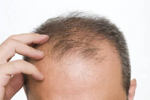 bald