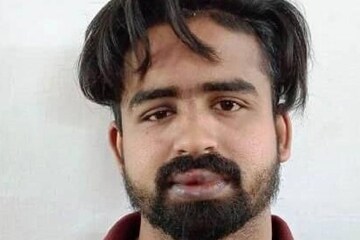 ബാറില്‍ സംഘർഷം; മധ്യവയസ്‌കന്റെ ജനനേന്ദ്രിയം യുവാവ് കടിച്ചു മുറിച്ചു