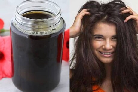 മുടി കൊഴിച്ചിൽ തടയുന്നതിനും ആരോഗ്യമുള്ള മുടിയിഴകൾക്കും ഈ ചെമ്പരത്തി എണ്ണ ഒന്ന് പരീക്ഷിച്ച് നോക്കൂ